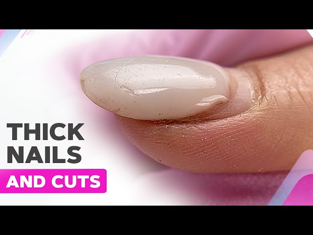 How to Fix MANICURE MISTAKES: Thick Coating and Overfiling