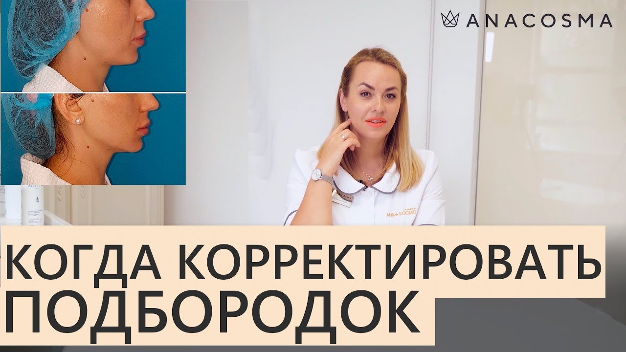 💧 КОРРЕКЦИЯ ПОДБОРОДКА ФИЛЛЕРАМИ 💧 ❗️ когда и как