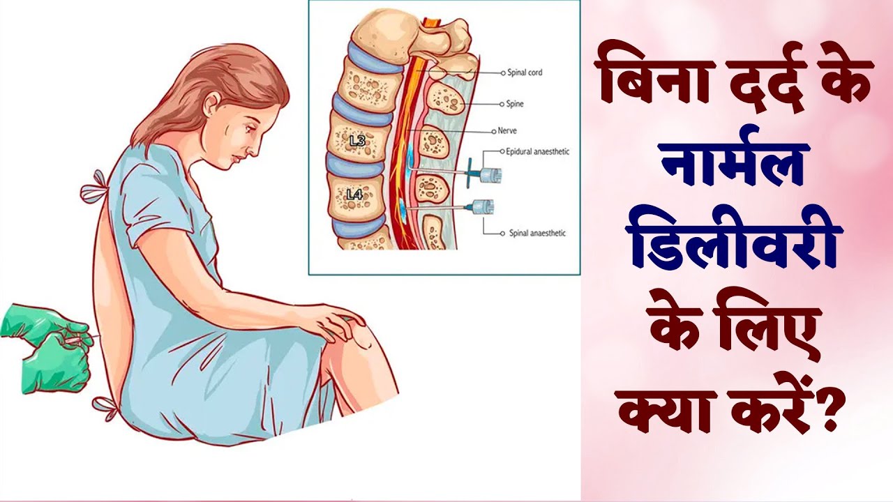  Painless Delivery Kaise Hoti