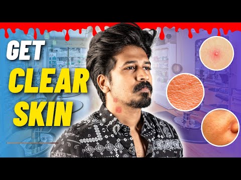 Simple Steps To Improve Your Skin (Clear Skin)