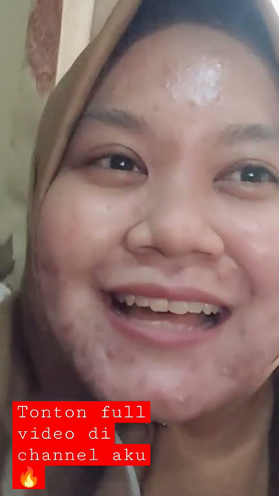 gini nih jadinya kalau berhenti pakai ms glow