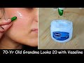 I Apply Vaseline + Aloe vera Gel + Vitamin E Oil on Face &amp; Removed Wrinkles - Skin Whitening Cream