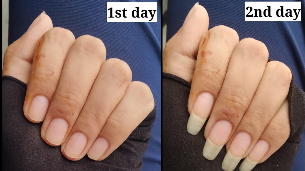 How to Grow Nails in 2 days How to Grow Nails Fast Faster Nail
