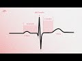 The cardiac cycle on an ekg pqrst waves