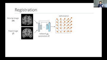 Keynote1 (Dr. Adrian Dalca): Unsupervised Learning of Image Correspondences in Neuroimaging