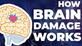 How Brain Damage Works