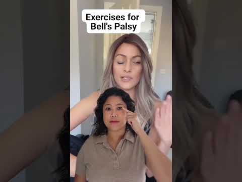 Exercises for Acute Bell’s Palsy
