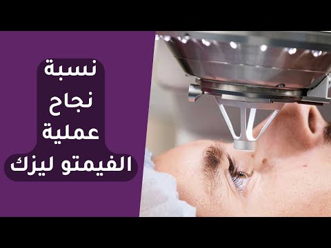 ما نسبة نجاح عملية الفيمتو ليزك ومتى يرجع النظر طبيعي