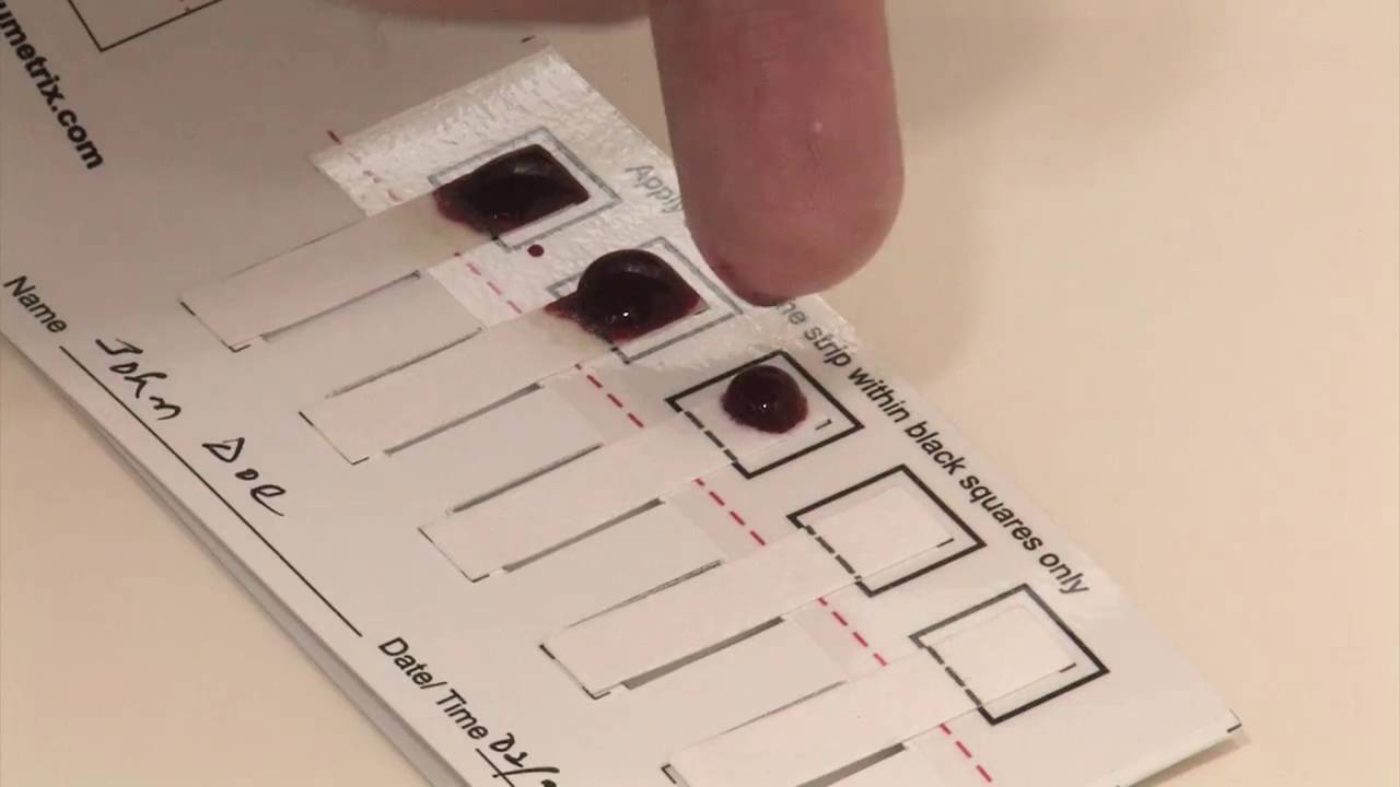 DRIED PLASMA SPOT COLLECTION YouTube