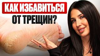 картинка: ТРЕЩИНЫ НА ПЯТКАХ. Как убрать НАВСЕГДА без кремов и аптек