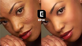 how to retouching photo face smooth and pimple remove  Epik app screenshot 3