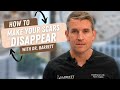 How to make your scars disappear  barrett plastic surgery