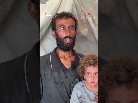 نازحة يمنية تروي معاناتها وظروفها الصعبة