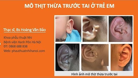 Cắt thịt thừa ở tai giá bao nhiêu năm 2024