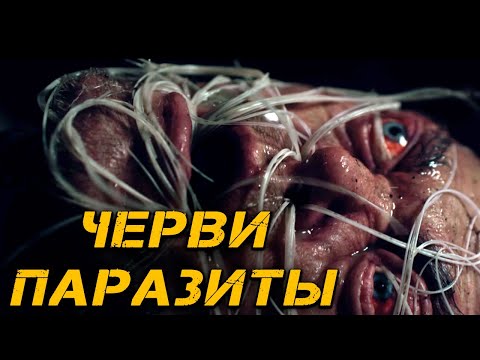 Видео: Дирофилярия | История Зла