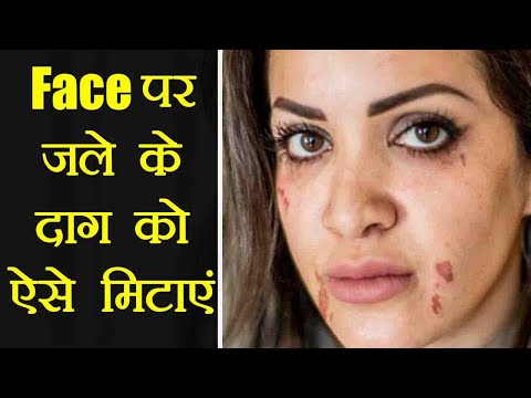 वीडियो: नकली निशान बनाने के 3 तरीके