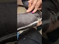 Getting my cast off
