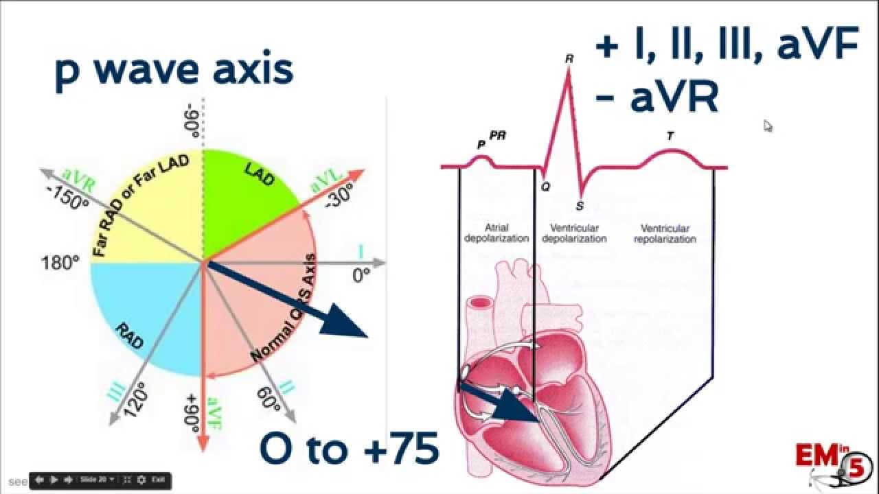 Ecg Axis Chart