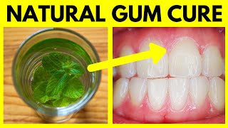 Best Mouthwash for Gum Disease – Cure Periodontal Disease & Gingivitis Natural Home Remedy Treatment