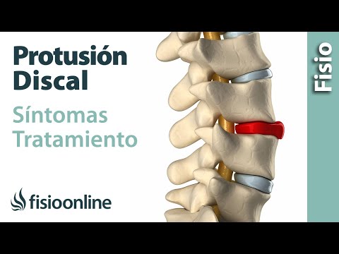 Vídeo: Protuberancia Del Disco Espinal Lumbar: Causas Y Tratamiento