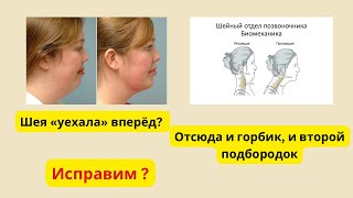 Убираем вдовий горбик (widow's hump) за счёт правильной позы