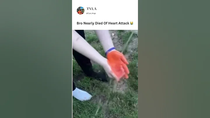 Young Man Almost Died Of A Heart Attack