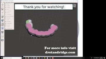 Anterior Deprogrammer Design using D3Splint (Pt 2)