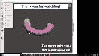 Anterior Deprogrammer Design using D3Splint (Pt 2)