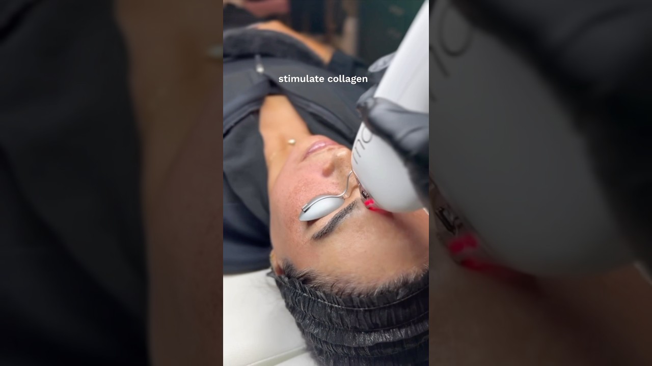 Best Laser Treatment For All Skin Types 