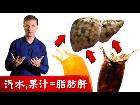 肝7. 汽水,果汁造成脂肪肝, 肝硬化,腹水,替代飲料,柏格醫生Dr Berg