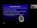 A Patient's Guide to Imaging Cerebral Cavernous Malformations