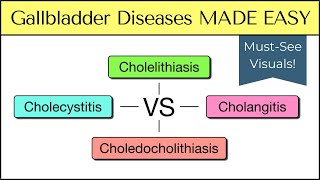 Cholecystitis vs Cholelithiasis vs Cholangitis vs Choledocholithiasis [Nursing, USMLE]