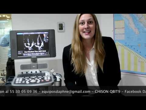 Dillies Medical - Chison Qbit