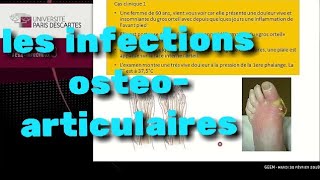 Infections ostéo-articulaires
#infections_ostéo_articulaires