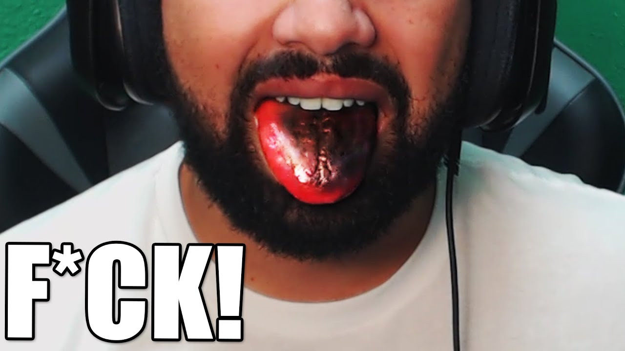 F*CK!! - I SHOULD Have NEVER DONE THIS! (EXTREME PAIN)