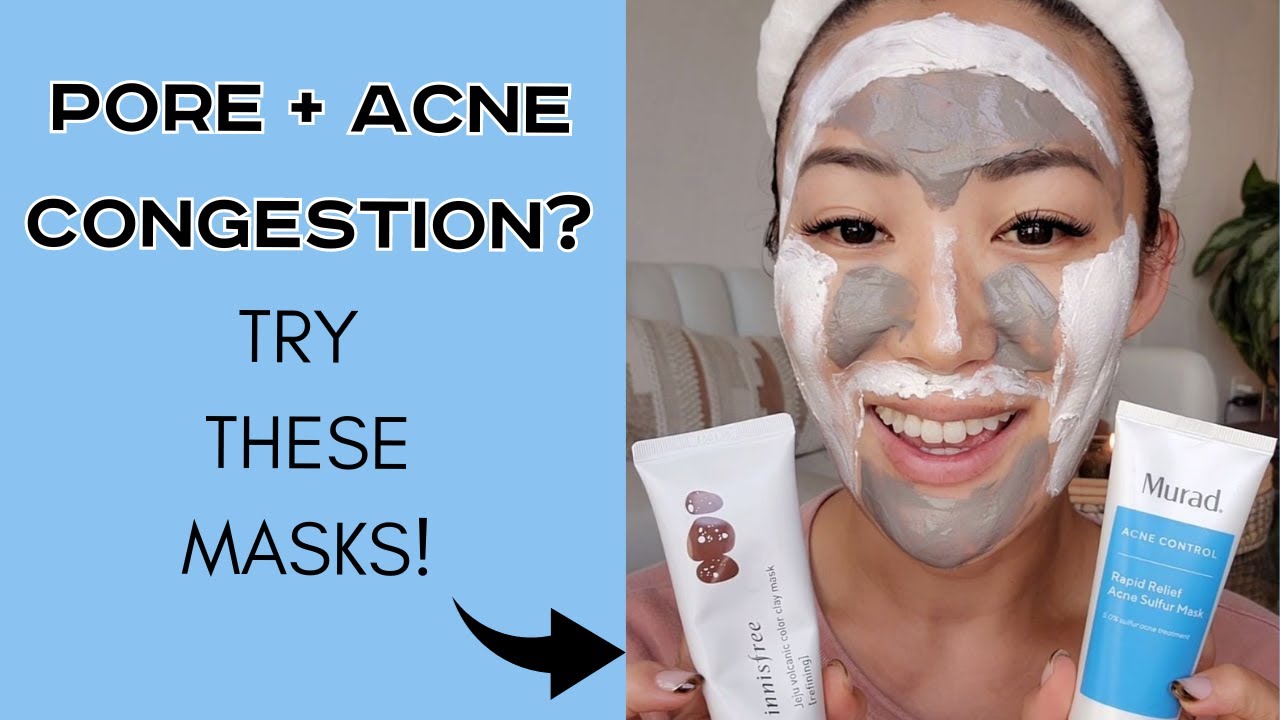 Acne + Pore Congestion? Try these Masks! 🧖‍♀️ 