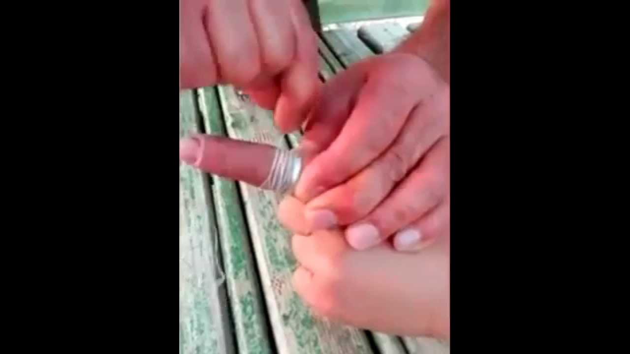 Как вытащить кольцо с пальца. Как вытащить кольцо с пальца