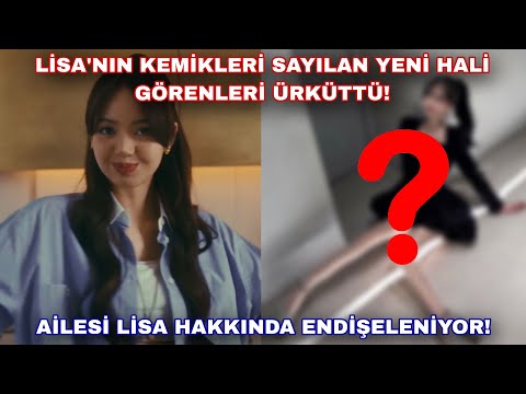 Lisa'nın kemikleri sayılan yeni hali görenleri ürküttü!! Ailesi Lisa hakkında endişeleniyor!!