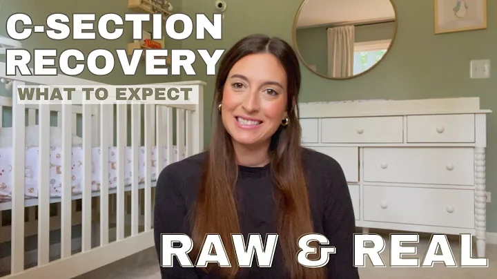 My 2nd C-Section Recovery | What Happens that No One Talks About | Tips for a Smoother Recovery