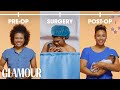 This is Your C-Section in 2 Minutes | Glamour