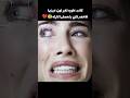 كانت عاوزه تغير لون عينيها الاخضر لكن بتحصلها كارثه  