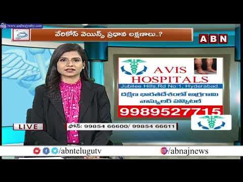ABN Clinic || Varicose Veins : Causes, Symptoms and Treatment || AVIS HOSPITALS || ABN Telugu