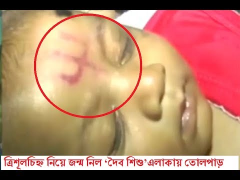 কপালে ত্রিশূল-চিহ্ন নিয়ে জন্ম নিল ‘দৈব শিশু’ । এলাকায় তোলপাড় Baby born with trident sign on forehead