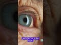 أسباب ضعف البصر ضعف البصر صحة العين رؤية صافية مشكلة البصر التهاب العين قصر النظر