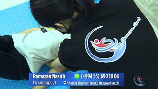 Skoliozdan Əziyyət Çəkən Pasiyentimiz Artıq Sağlığına Qovuşur.