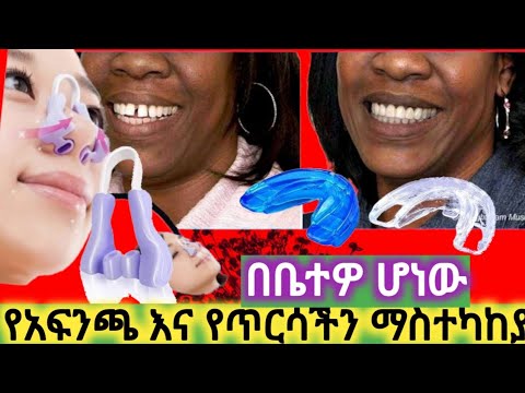 ቪዲዮ: የተሰበረ አፍንጫን ለማከም 3 ቀላል መንገዶች