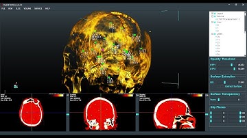 How to create Labels or Landmarks over 3D DICOM or Volume Images in Real3d VolViCon?