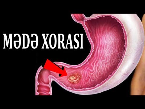 Video: Koprofagiya Və Itlərdə Həzm Fermenti çatışmazlığı Ilə əlaqəsi