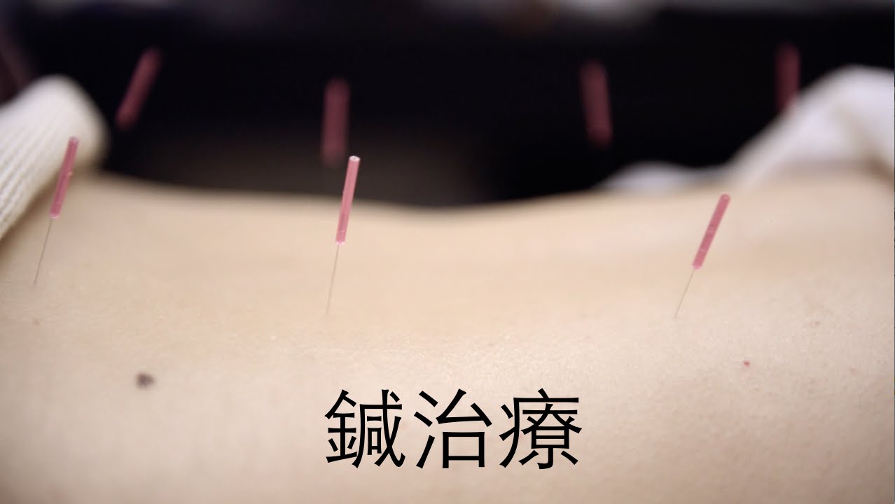 鍼治療 Acupuncture by Chi Yu Wellness Centre (in Japanese) - YouTube