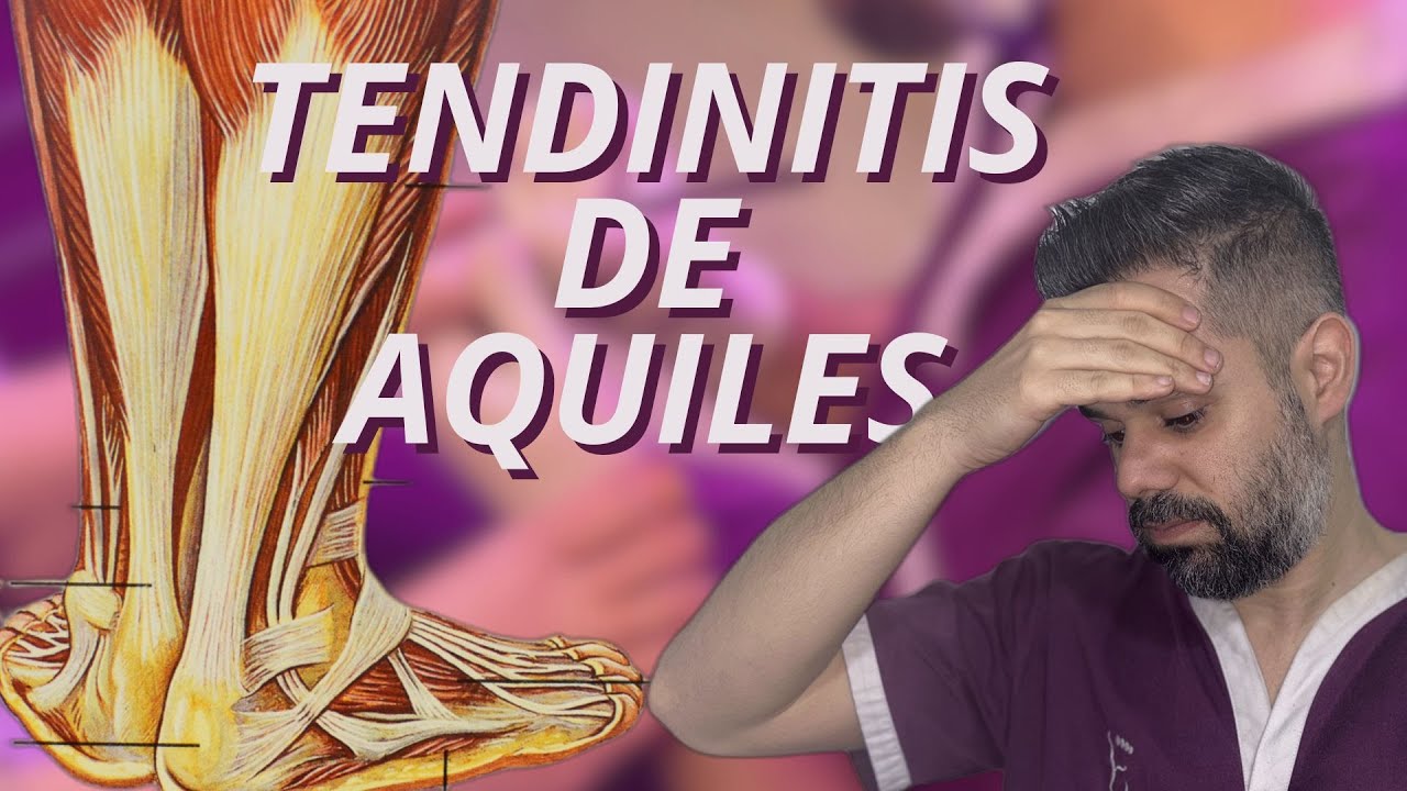 Tendinitis de Aquiles - TODO LO QUE DEBES SABER